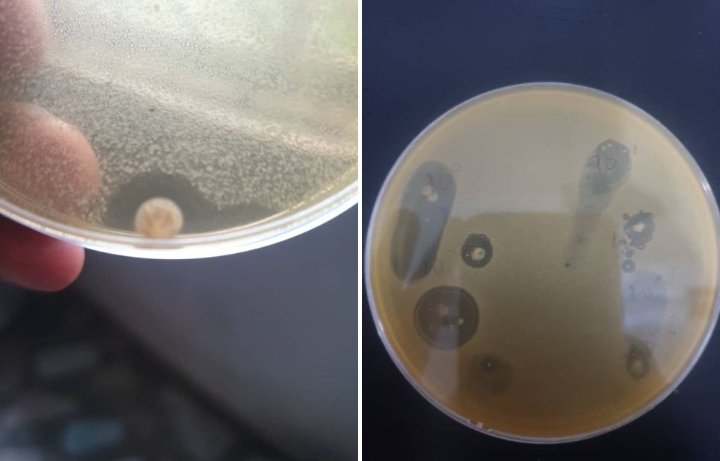 When Science Surprises You: The Value of Following the Unexpected